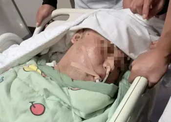 河北31岁高中教师突发脑出血进ICU，病发至今快一个月仍未清醒
New