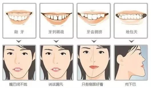 宜宾这2家牙科诊所做活动啦！学生矫正超低价，还送千元大礼包！-9.jpg
