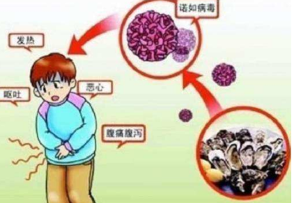 宜宾人注意！诺如病毒到高发期了，外地已有学校停课！-3.png