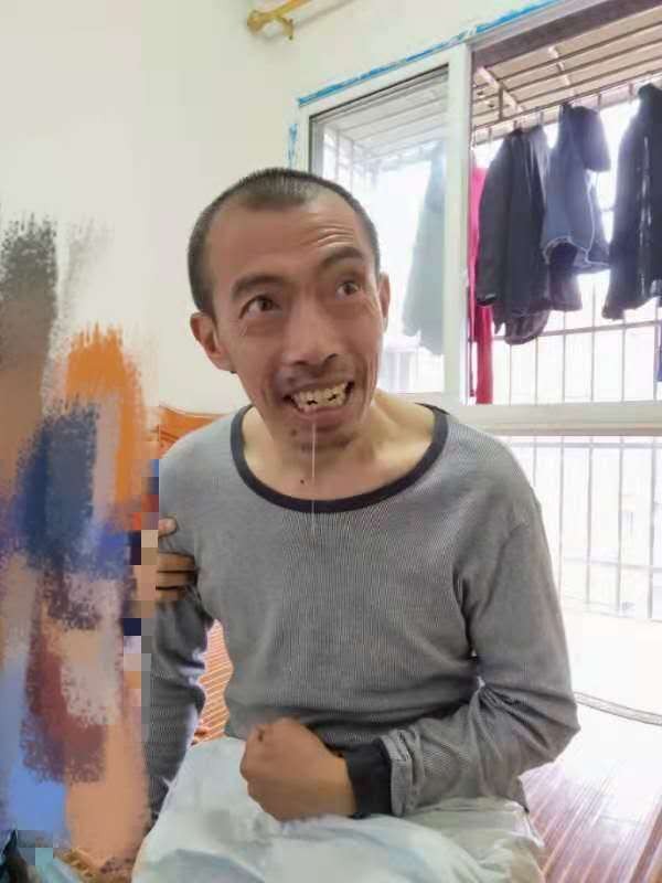 紧急求助！我被诊断为蛛网膜下脑出血，请大家帮帮我！-3.jpg