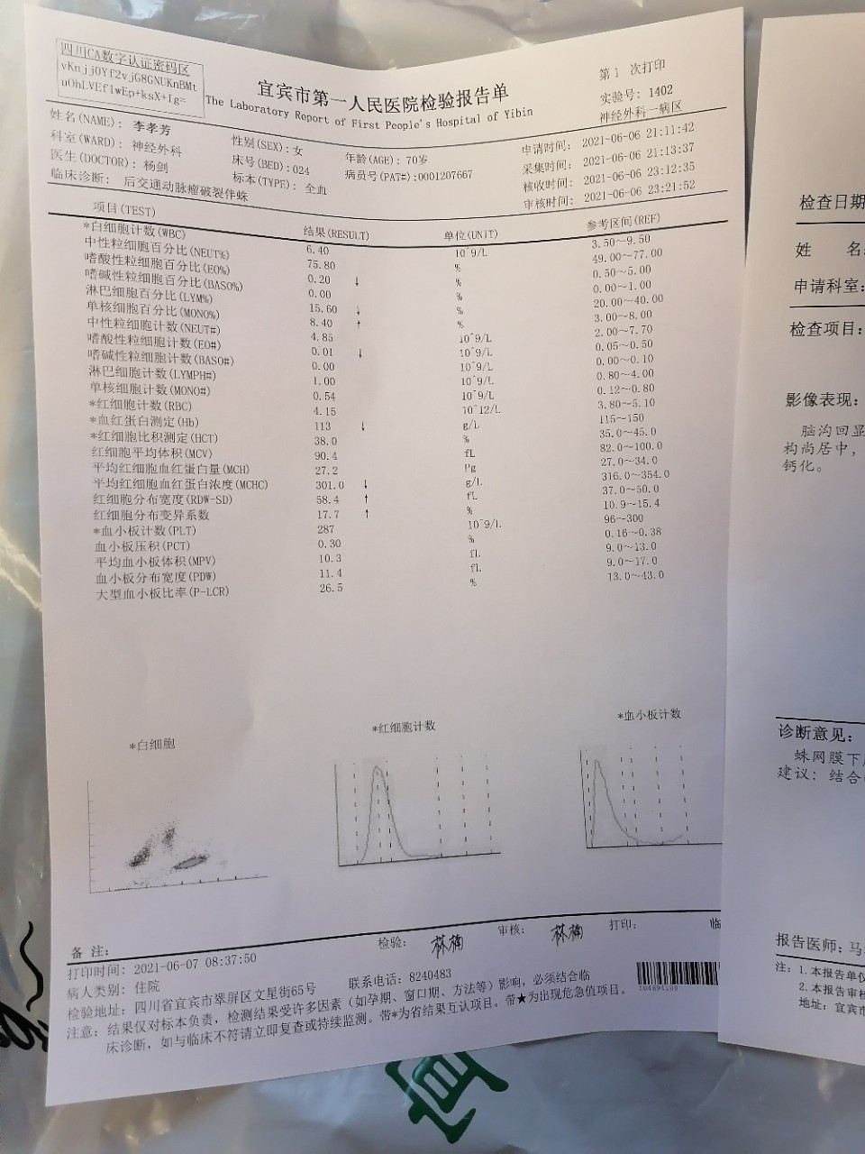 紧急求助！我被诊断为蛛网膜下脑出血，请大家帮帮我！-7.jpg