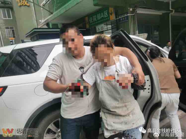 情况紧急！宜宾一女子上班时不慎将十个手指全部切割.....-1.jpg