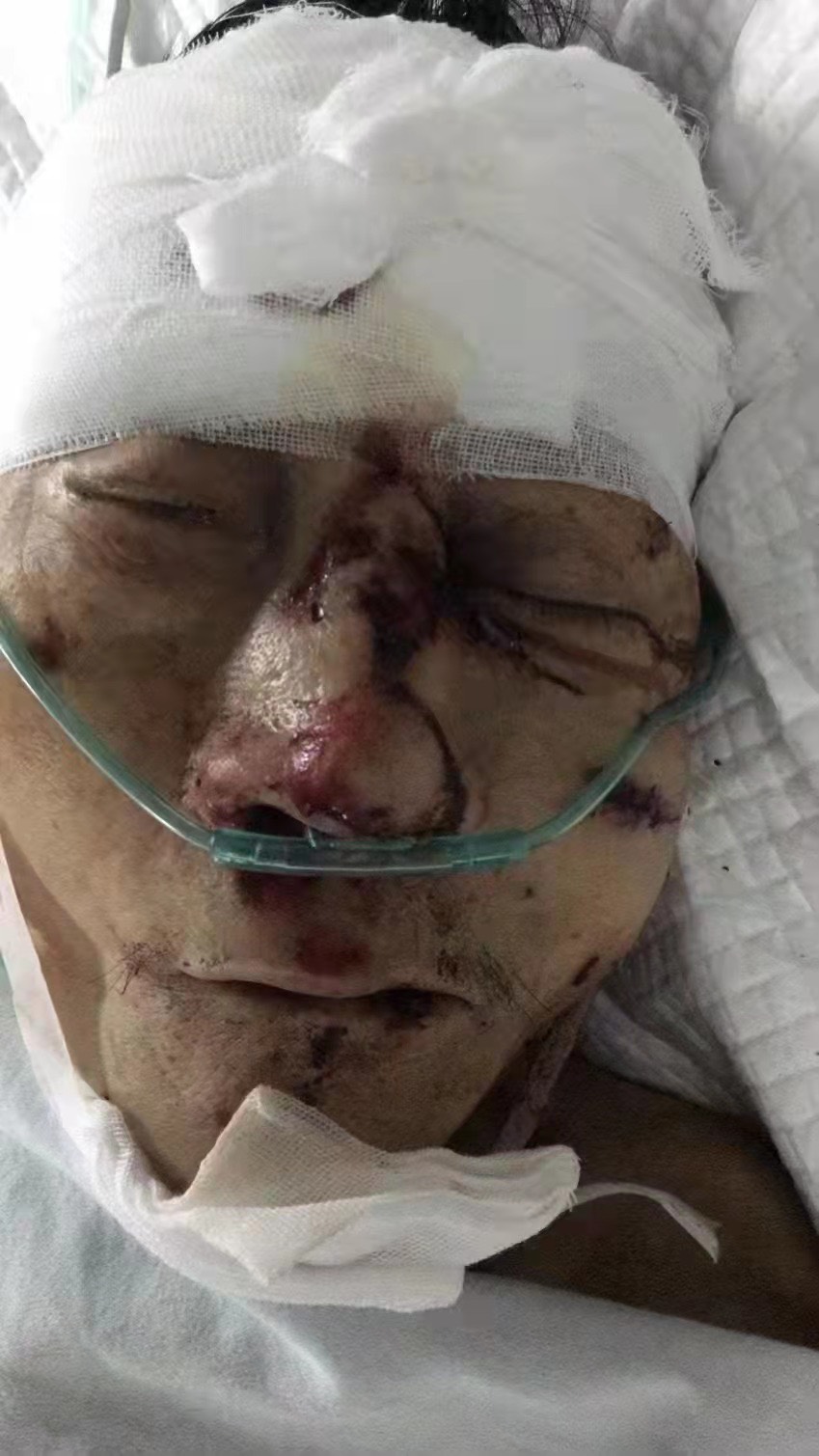 扩散寻找家属！南溪凤凰大道发生车祸，一60岁左右男性老人生命垂危，好可怜！-1.jpg