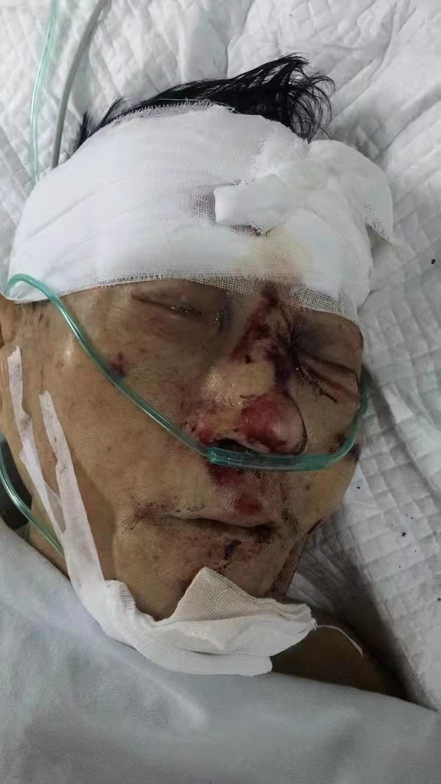 扩散寻找家属！南溪凤凰大道发生车祸，一60岁左右男性老人生命垂危，好可怜！-2.jpg