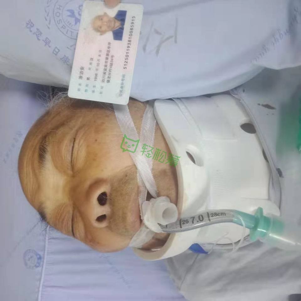 紧急求助！8旬老人，不幸意外摔倒，全身粉碎性骨折加内出血！-1.jpg