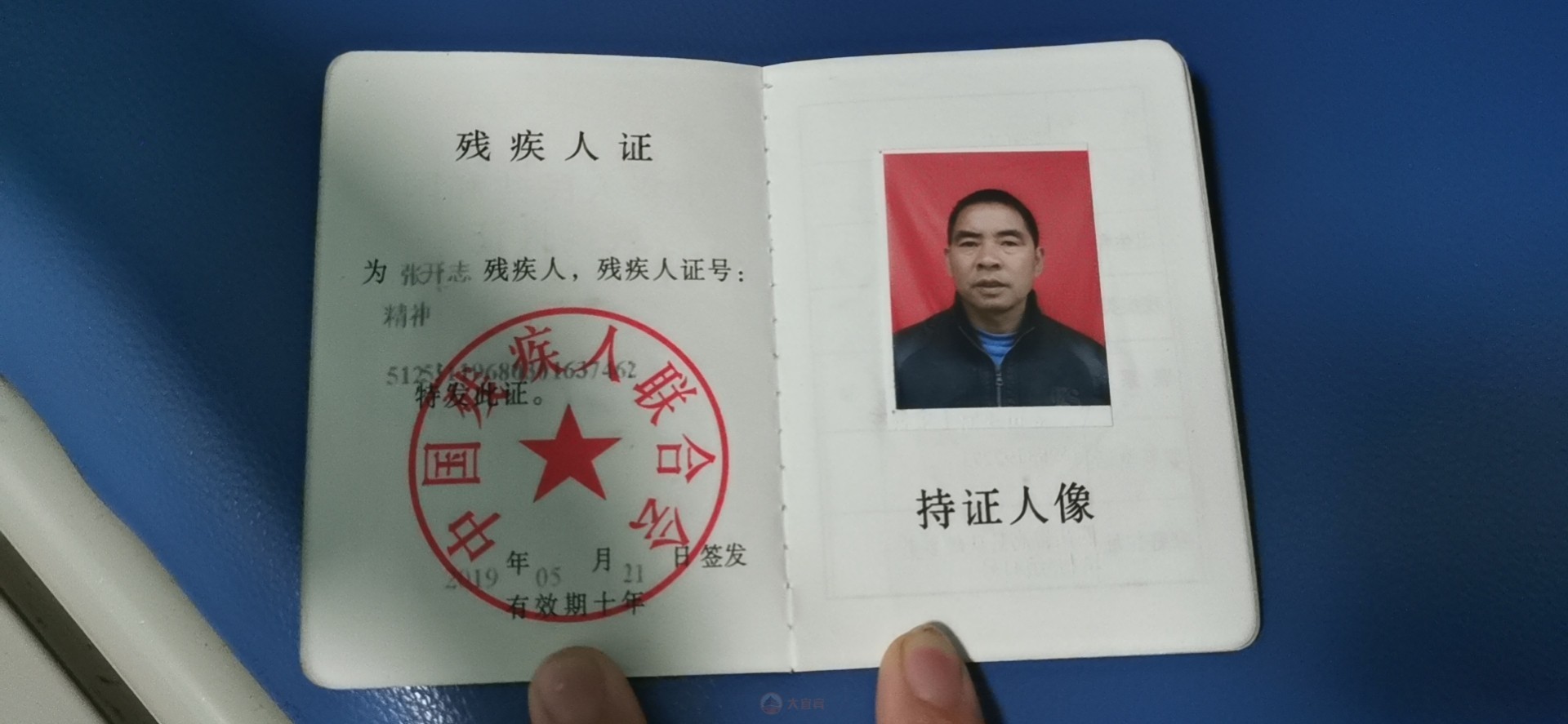 求助！我家在宜宾农村，爸爸车祸康复后再次头皮感染，需重新补头骨…-7.jpg