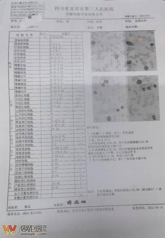 急急急，宜宾一位66岁病人急需AB型血小板！-2.jpg